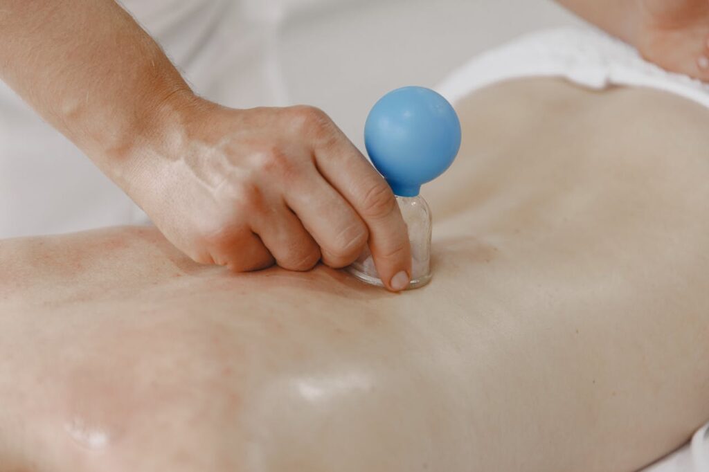 Holistisch Cupping Massage